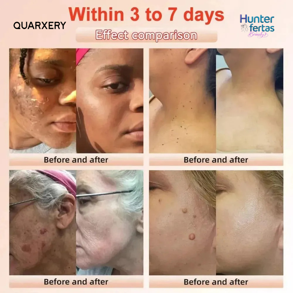 Quarxery - Limpieza Profunda que Renueva